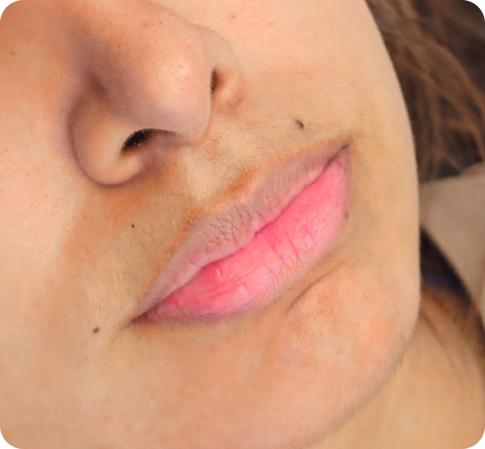 Antes