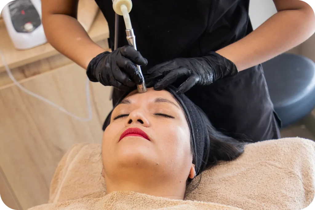 Tratamiento de Exosomas faciales