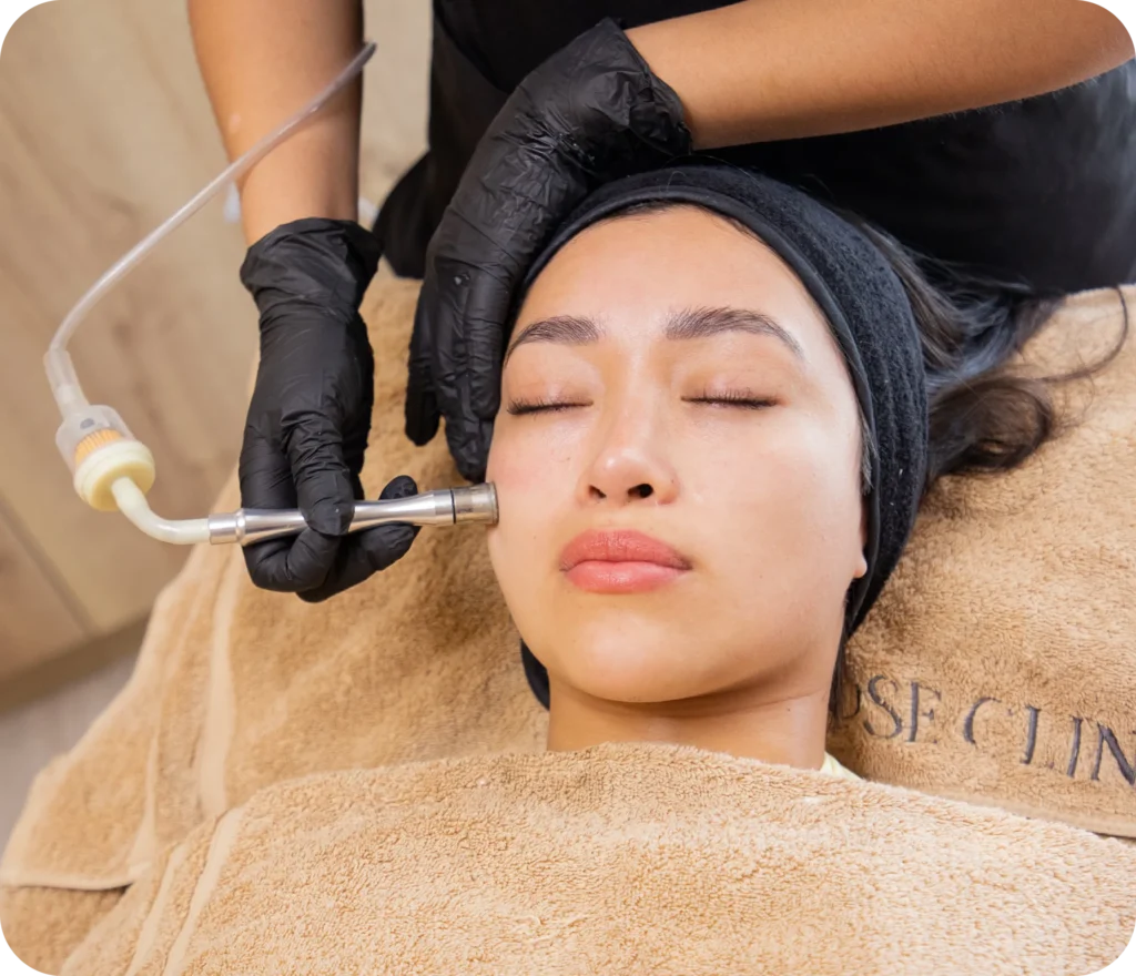 BIOPEN + ESTHEMAX CON PRP en Miraflores