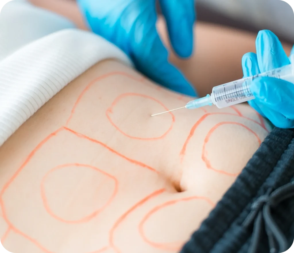Tratamiento con enzimas recombinantes en Miraflores