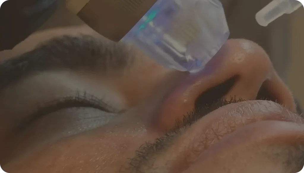 Limpieza facial